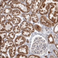 NBP1-91226 - Junctophilin-3 / JPH3