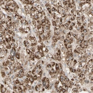 NBP1-87802 - KDM5A / JARID1A