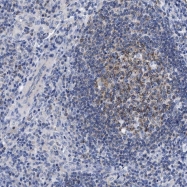 NBP1-87723 - JAW1 / LRMP