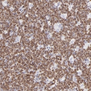 NBP1-87724 - JAW1 / LRMP