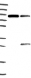 NBP1-87864 - Josephin-1 / JOSD1