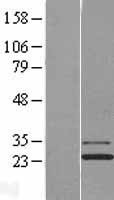 NBL1-12108 - Josephin1 Lysate