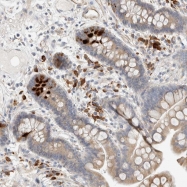 NBP1-80723 - KBTBD5 / SRYP
