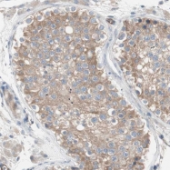 NBP1-91198 - LPPR4 / PRG1