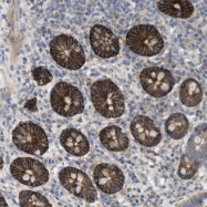 NBP1-81334 - KCNS3