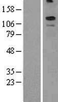 NBL1-12205 - KCNT2 Lysate