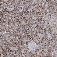 NBP1-82860 - KCNV2
