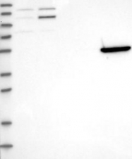 NBP1-82860 - KCNV2