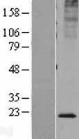 NBL1-12221 - KDELR2 Lysate