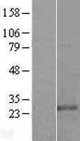 NBL1-12222 - KDELR3 Lysate