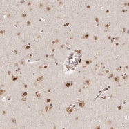 NBP1-86359 - KIAA0240
