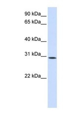 NBP1-69581 - KIAA0247