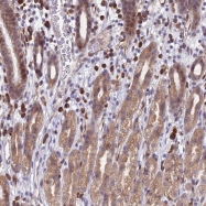 NBP1-86539 - KIAA0649