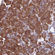 NBP1-92051 - KIAA1143