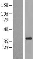 NBL1-12261 - KIAA1191 Lysate
