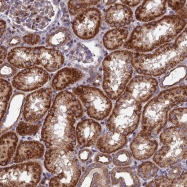 NBP1-93850 - KIAA1468