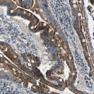 NBP1-88912 - KIF1A