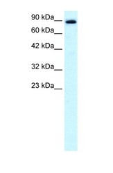 NBP1-58143 - KIF21A
