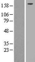 NBL1-12292 - KIF21A Lysate