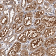 NBP1-90443 - KIF26B