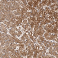 NBP1-90445 - KIF26B