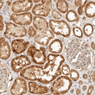 NBP1-86416 - KIF2B
