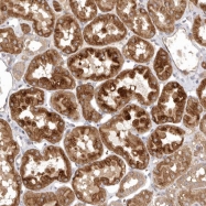 NBP1-89446 - KIF2B