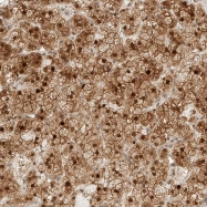 NBP1-81569 - KIFAP3 / SMAP