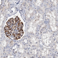 NBP1-93446 - KIRREL1
