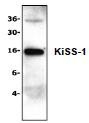 NBP1-45672 - KiSS-1