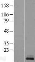 NBL1-12305 - Kisspeptin Lysate