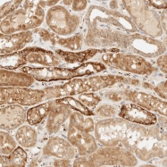 NBP1-81917 - ZNF393