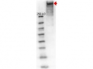 NB120-7054 - KLH