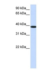 NBP1-70592 - KLHDC8B
