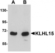 NBP1-77359 - KLHL15