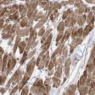 NBP1-94016 - KLHL18