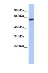NBP1-55462 - KLHL7