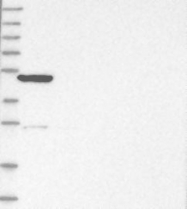 NBP1-82871 - KLHL7