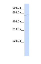 NBP1-52978 - KPNA5 / Importin alpha-6