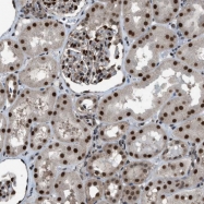 NBP1-83762 - KPNA6 / Importin alpha-7