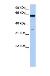 NBP1-52953 - KPNA6 / Importin alpha-7