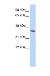NBP1-70595 - KRT222P / KA21