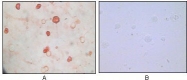 NB100-2189 - Herpes Virus Type 8 / HHV8
