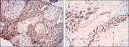 NB100-2189 - Herpes Virus Type 8 / HHV8