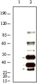 NB100-2189 - Herpes Virus Type 8 / HHV8