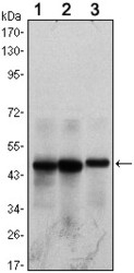 NB100-2189 - Herpes Virus Type 8 / HHV8