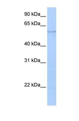 NBP1-56545 - Kynureninase