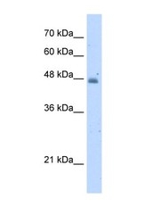 NBP1-57569 - Kynureninase