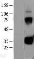 NBL1-12343 - Kallikrein 1 Lysate