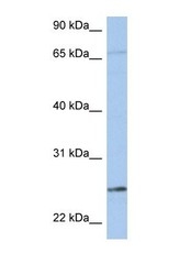 NBP1-54713 - KLK6 / Kallikrein-6